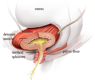 Overactive bladder contracting inappropriately